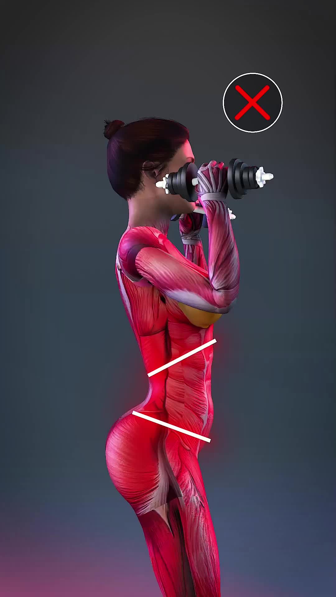 X